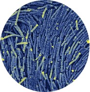 Bacillus Coagulans